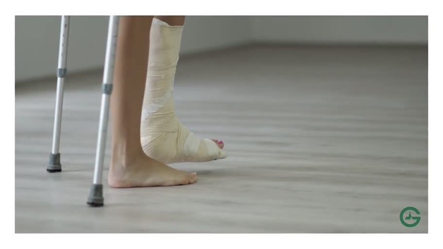 Une personne en béquilles avec le pied dans le plâtre